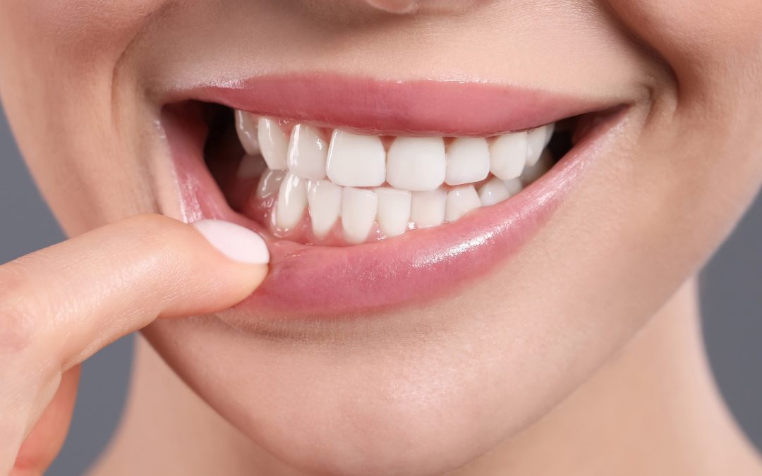 Melbourne Family Dental: Where Every Smile Matters